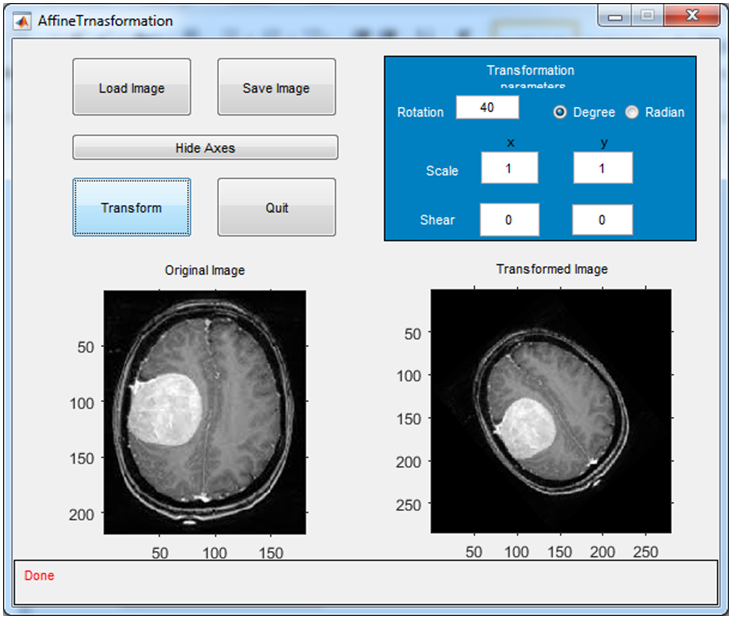 PhD Research Topics in Biomedical Engineering